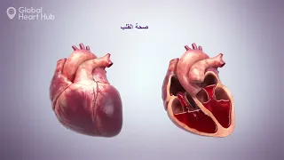 Egypt (Arabic) - Heart Failure Awareness Week - Campaign Animation