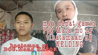 Mga dapat gawin Pag tinamaan Ang Mata sa welding I by mang HATOR I Curan Works