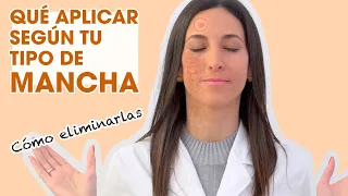 🌼BELLA AURORA🌼 ¡Ponle solución a las manchas! | Mifarma Farmacia