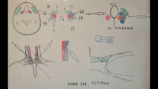 Катетеризация внутренней яремной вены по анатомическим ориентирам (venae jugulares).