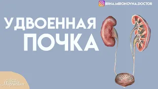 Удвоенная почка.