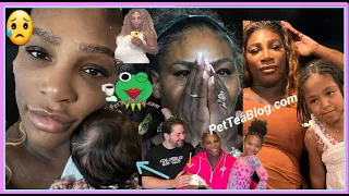 Serena Williams Suffering Postpartum Depression with 2nd Daughter, Fears Being Bad MOM "I'm NOT OK"❌