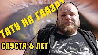 ТАТУ НА ГЛАЗАХ спустя 6 лет заключение доктора