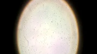 sperm under the microscope 1000x - HD  - Male Fertility