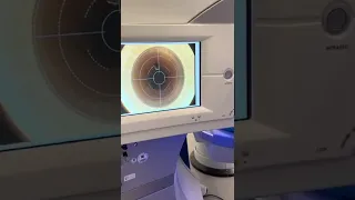 So sieht eine Augen Operation aus 😦 #anzeige