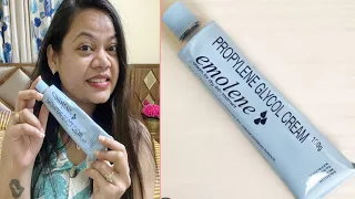 बहुत सारे Moisturiser Use किए कोई अच्छा Moisturiser नहीं मिला Try Emolene Cream