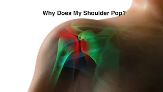 Why Does My Shoulder Snap and Pop?