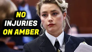 LAPD Officer Testifies He Did NOT See Injuries On Amber Heard