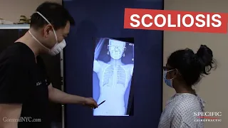 Childhood Scoliosis and Sciatica helped Dr Suh Gonstead Chiropractic NYC
