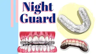 Night Guard :: Types of the night guard / Mouth Splint