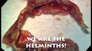 Helminth in Your Gut