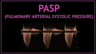 PASP (pulmonary artery systolic pressure)