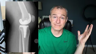 Knee Replacement - Frustrated by Lack of Progress: "What should I do?"