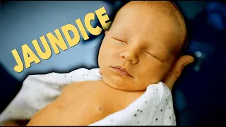 NEWBORN WITH JAUNDICE! (Why Parents Can't Miss This) | Dr. Paul