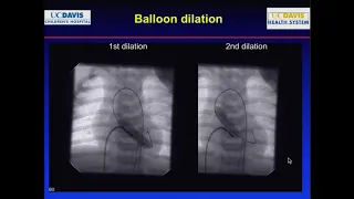 Complications in the cath lab Part2 : Interventions