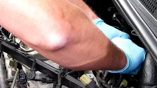 Hyundai Tucson EGR Removal   Step By Step Pt1