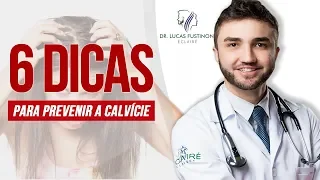 💥 6 Dicas para PREVENIR a CALVÍCIE | Queda de Cabelo | Dr Lucas Fustinoni