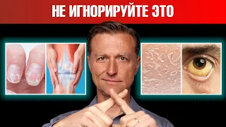 Устраните дефицит этих 17 нутриентов с помощью суперфудов 🔥