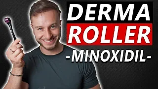 How To Use Derma Roller and Minoxidil to Regrow Hair!