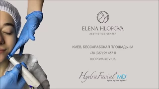 ГИДРОПИЛИНГ HydraFacial • Безболезненная чистка лица • Центр косметологии Елены Хлоповой