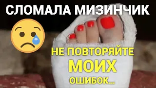 Перелом мизинца на ноге. Что будет, если не идти в травмпункт. Просто дневник Константиновой.