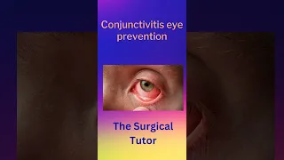 Causes of Conjuctivitis #bacterial conjunctivitis / pink eye #allergic conjunctivitis