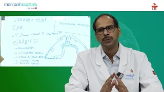Manipal Hospital Vijayawada | Symptoms and Causes of Lung Cancer | Dr. Krishna Reddy