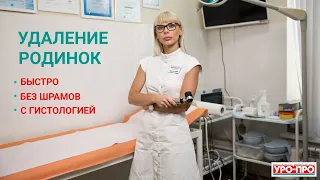 Удаление родинок в Ростове-на-Дону | Центр Дерматологии УРО-ПРО