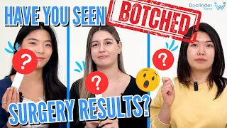 Have you seen Botched Surgery results? 😱 Docfinderkorea QnA | Plastic Surgery in Korea. Part 1