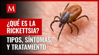 ¿Qué es la rickettsia, cómo se contagia y cuáles son los síntomas?