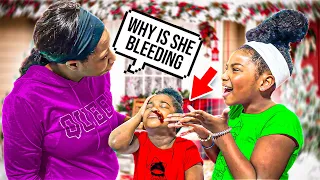 Girl gets a Bloody NOSE, What happens next is shocking| Big E Family