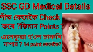 SSC GD Medical Details | দাত কেনেকৈ check কৰে | Dental Points আপোনাৰ  কিমান চাই লওক ? #SSCgd #ap #AR