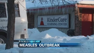 Measles Outbreak Hits Illinois