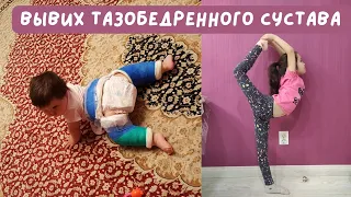 Врожденный вывих бедра, дисплазия тазобедренного сустава. Гипс, шина. Congenital hip dislocation.