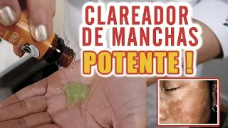 O mais Potente Clareador para ACABAR com MANCHAS NA PELE !