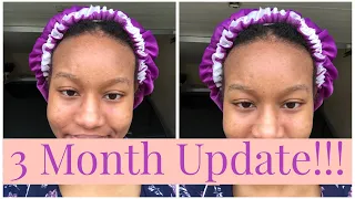 3 Month Metronidazole Cream for Perioral Dermatitis Update | Before and After Photos Included!