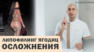 ЛИПОФИЛИНГ ЯГОДИЦ 🍑🔥ОСЛОЖНЕНИЯ😱⛔ КАК ИЗБЕЖАТЬ?