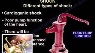 Hemorragic Shock,causes ,signs and management  ,  Everything You Need To Know - Dr. Nabil Ebraheim