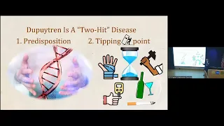 2023 Dupuytren Disease and Research for a Cure