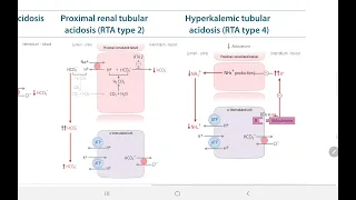 Renal Tubular Acidosis RTA | BACK BENCHER'S ACADEMY | First Aid USMLE Step 1