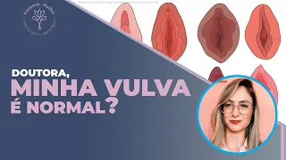 Doutora, minha vulva é normal?