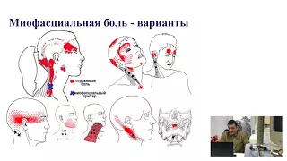 Лечение цервикалгии и цервикокраниалгии. Баринов А.Н. (Мск)