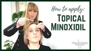 How to Apply Topical Minoxidil
