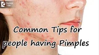 Common Tips for people having Acne or Pimples - Dr. Sankeerth Vijayakumar
