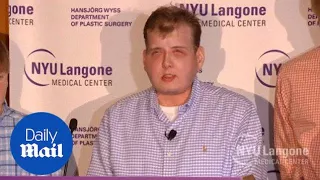 Patrick Hardison talks about life a year after his face transplant - Daily Mail