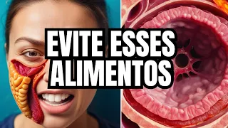 ❌ PARE de comer isso na SÍNDROME DO INTESTINO IRRITÁVEL!!!