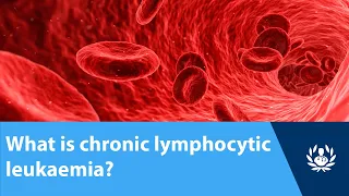 What is chronic lymphocytic leukaemia?