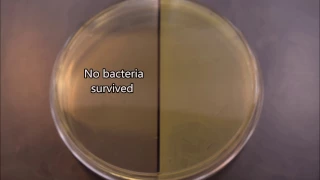 UV effects on bacteria time-lapse