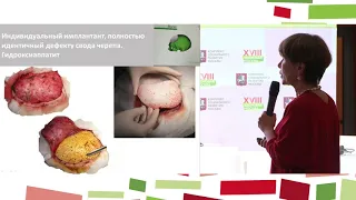 Сессия «Инновационные технологии и мультидисциплинарный подход в детской нейрохирургии»