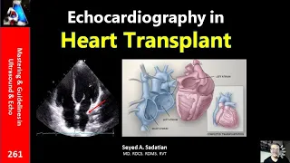 Echocardiography in Heart Transplant